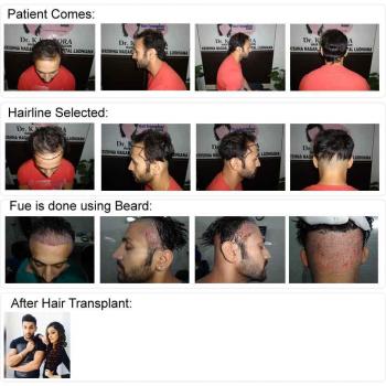 HairTree hairtreehairtransplantclinic  Instagram photos and videos