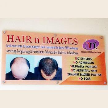 Hair N Images - Hair Transplant clinic in Surat - Vapi | Gujarat | India