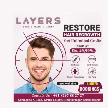 Hair Replacement Non-Surgical - Bglam hair studio | Hyderabad | Telangana |  India